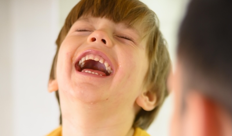 Problemi odontoiatrici nei bambini: quali sono i più comuni?