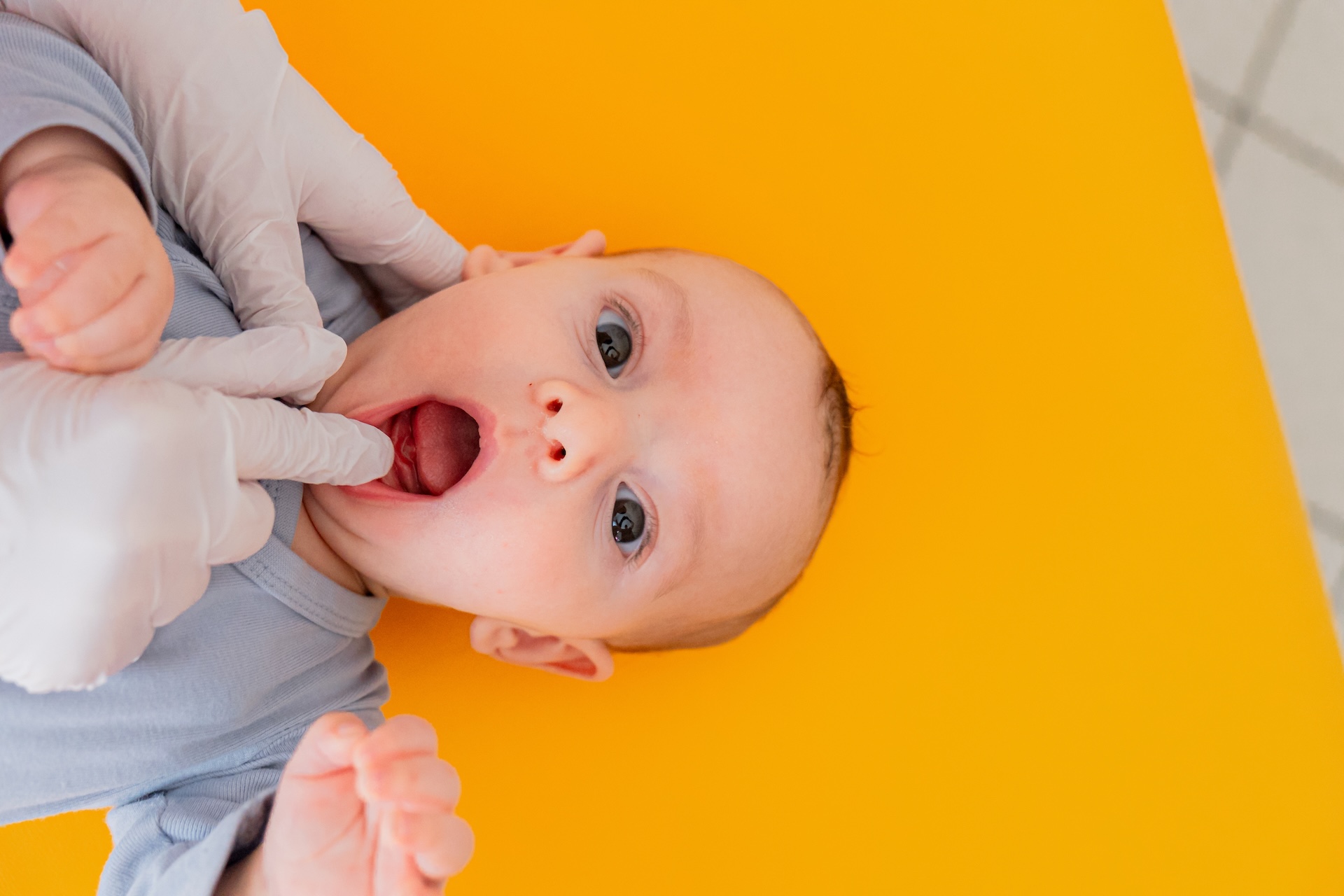 Logopedia neonatale Bologna