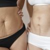 Dolori dopo parto cesareo Bologna: come risolverli